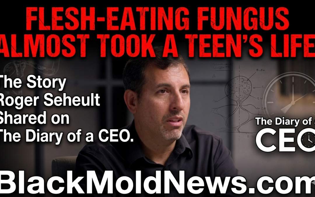 Flesh-Eating Fungus Almost Took a Teen’s Life: The Story Roger Seheult Shared on The Diary of a CEO